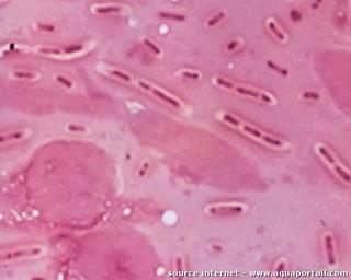 Entrobactrie Klebsiella