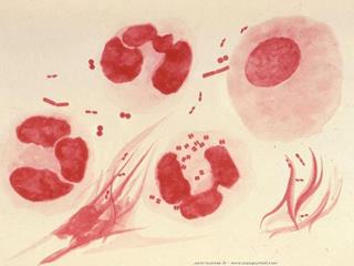 Neisseria gonorrhoeae au microscope