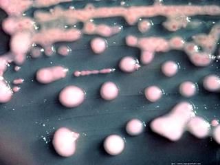 Klebsiella pneumoniae