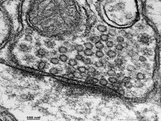 Une lectronographie de synapse