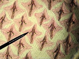 Des cailles placodes de requin au microscope