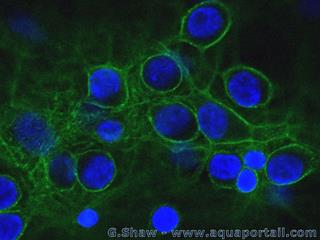 Spectrine dans une membrane plasmique