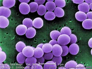 Bactrie staphylocoque dor Staphylococcus aureus
