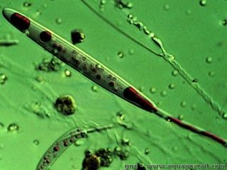 Un nmatocyste au microscope