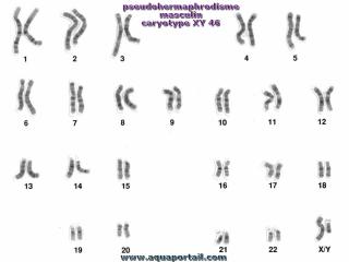 pseudohermaphrodisme