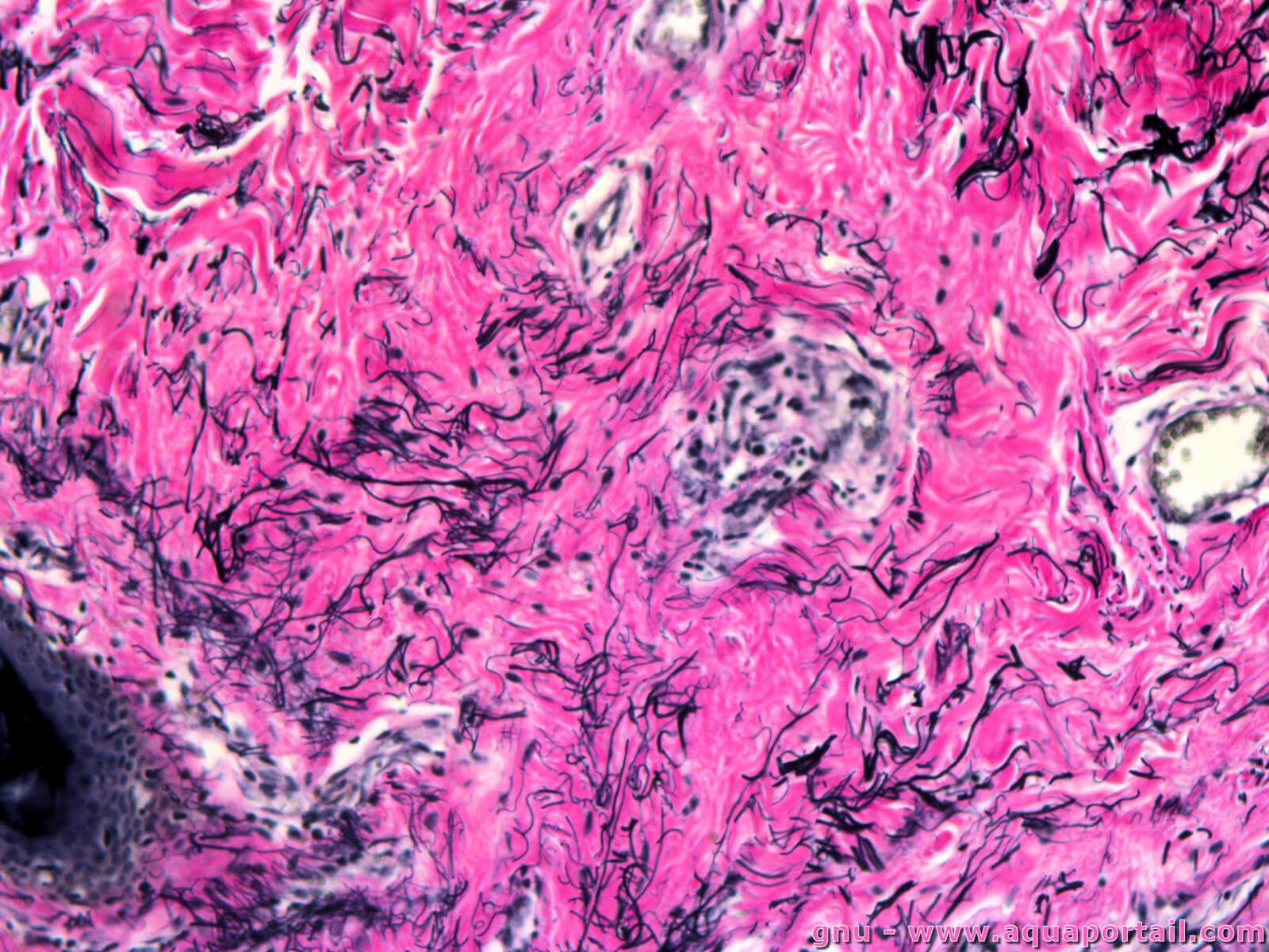 proteine elastique de la peau des os et tissus au