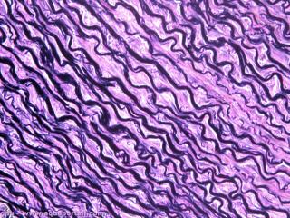 Fibres lastiques en lastine de l'aorte