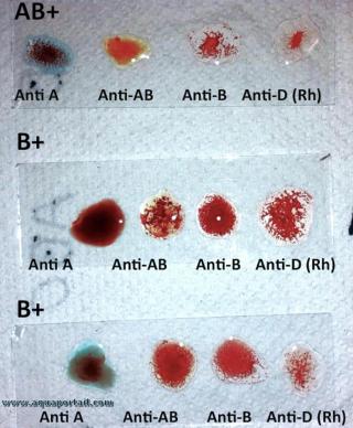 hmagglutination