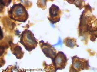 microglie