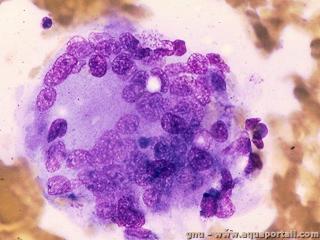 Une cellule multinucle polynuclaire