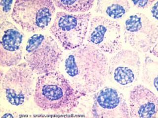 Des mastocytes colors au bleu de toluidine