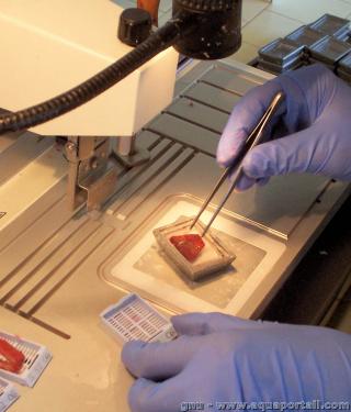 La pathologie tudie les tissus