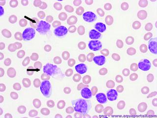 lymphocytose