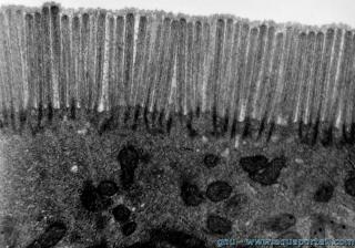 microvillosit