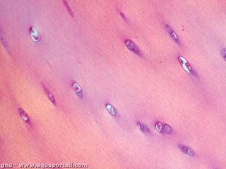 chondrocyte