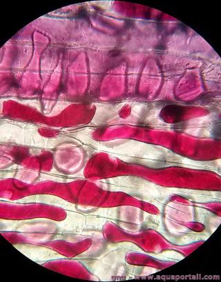 Plamsmolyse de celules d'oignon