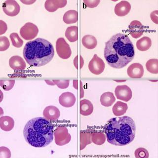 inclusion cytoplasmique