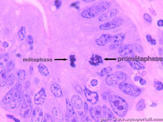 Comparaison entre mtaphase ( gauche) et promtaphase ( droite)