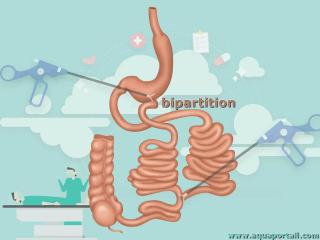 bipartition