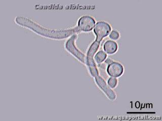 Photo de tube germinatif et ses synonymes. Tubes germinatifs de la levure Candida albicans