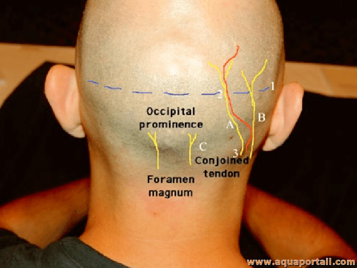 Douleurs Occipitales Traitement KOSE