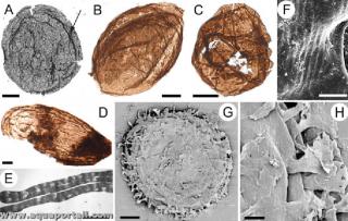 palomicrobiologie