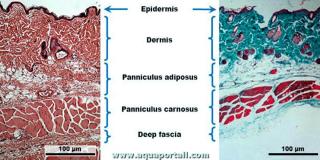 Pannicules adipeux et carn au-dessus du fascia