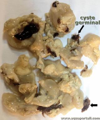 Cystes germinaux