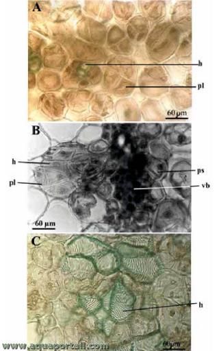 Hydrocytes (hyalocystes) de jonquilles, jacinthes et lis
