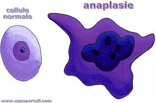 anaplasie