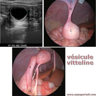 Vsicule vitelline