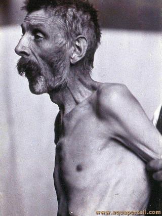 maciation d'un homme