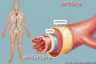 endartre