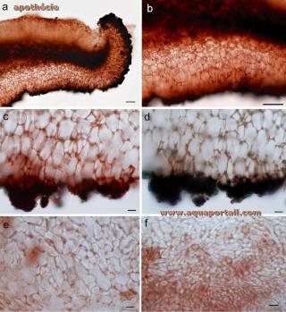 excipulum