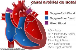 Canal artriel de Botal