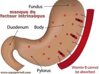 Facteur intrinsque et vitamine B12