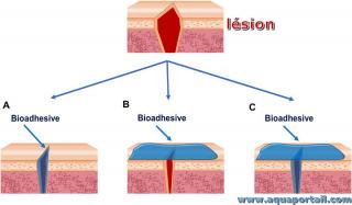 bioadhsif
