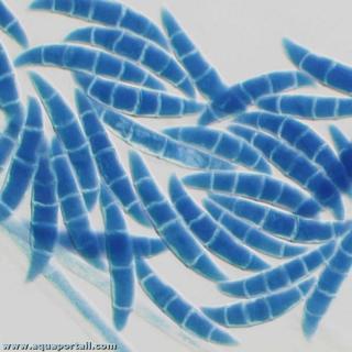 Fusarium culmorum au microscope