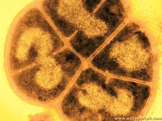 Deinococcus radiodurans