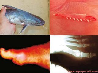 Poisson traumatogne et blessure
