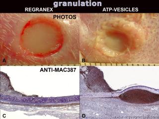 Granulation solide d'une plaie