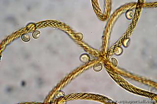 Capillitium de Trichia varia