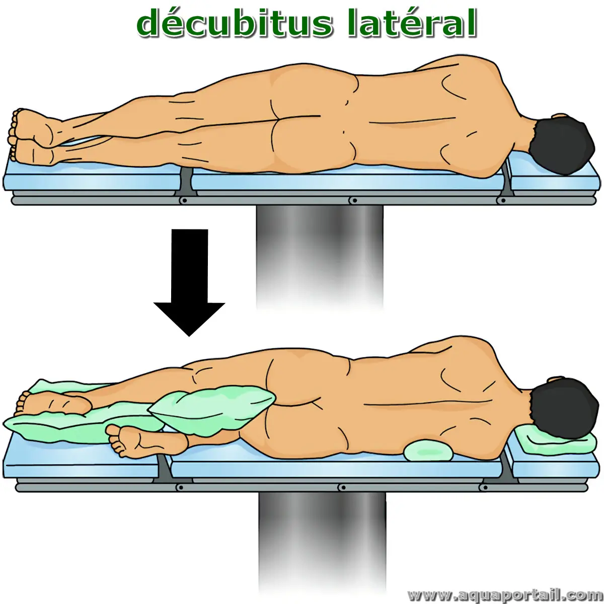 décubitus latéral